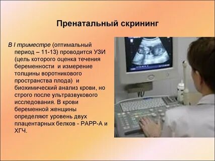 Узи это простыми словами