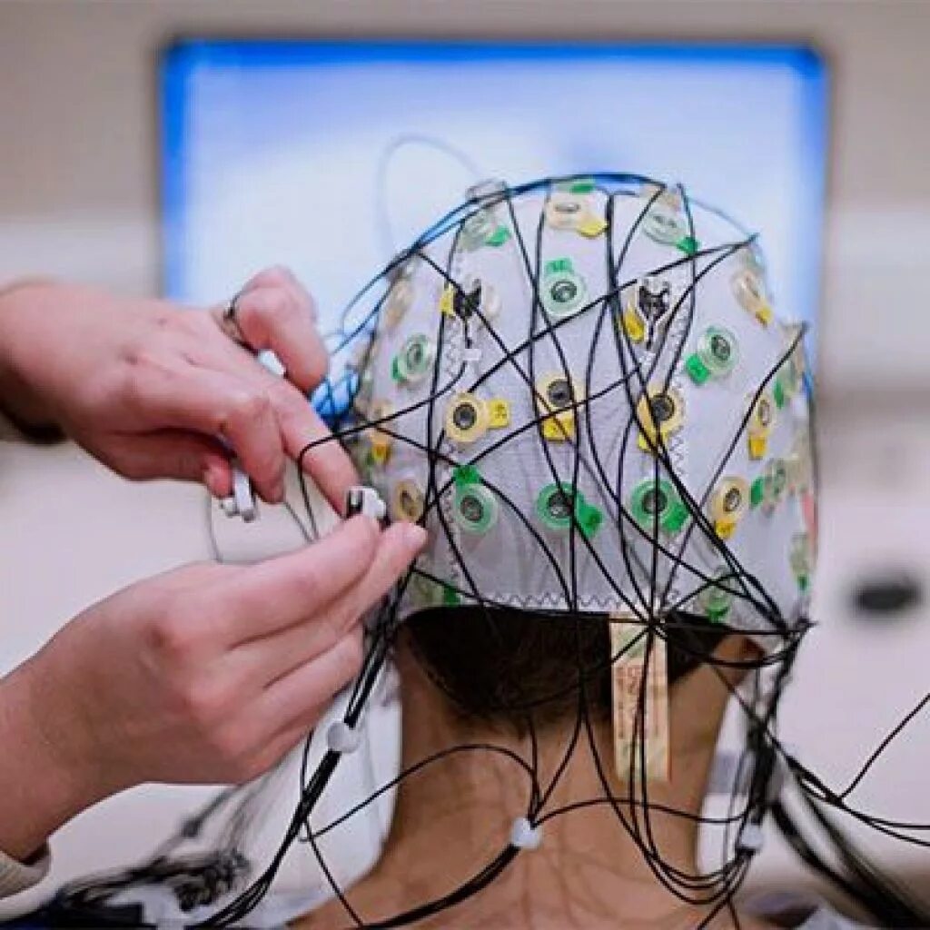 Диагностика ээг. Электроэнцефалография (ЭЭГ). EEG elektroentsefalografiya. Нейротех ЭЭГ. Электроэнцефалографическое исследование (ЭЭГ.