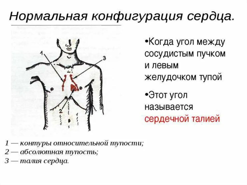 Аортальная конфигурация сердца при перкуссии. Конфигурация относительной тупости сердца. Митральная конфигурация сердца при перкуссии. Угол между сосудистым пучком и левым желудочком. Длинник и поперечник