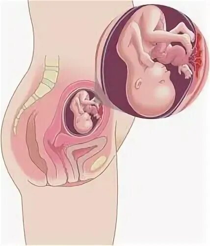 Шевеление плода на 18 неделе