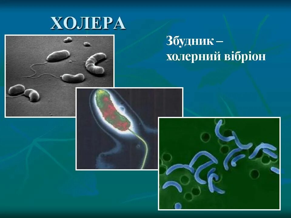 Болезнетворная бактерия 7. Холера бактерия. Болезнетворные бактерии холера. Вибрионы бактерии.