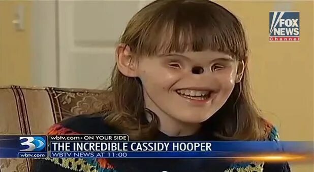 Кэссиди Хупер (Cassidy Hooper. Человек родился без глаз.
