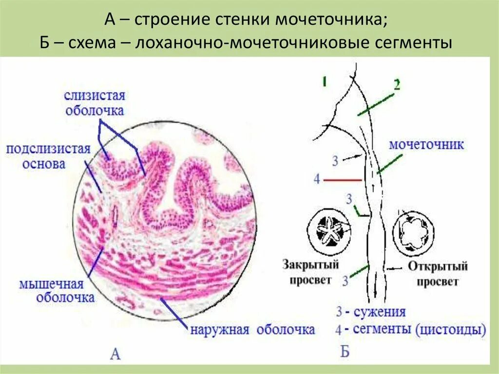 Мочеточникового сегмента