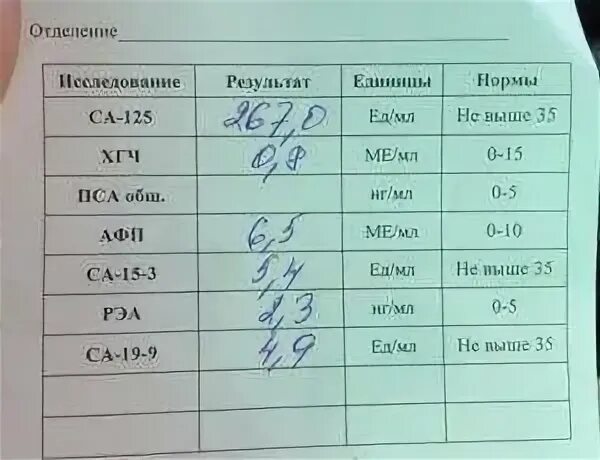 Са 125 натощак
