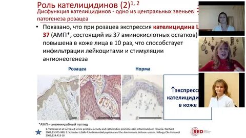 Розацеа схема лечения у женщин