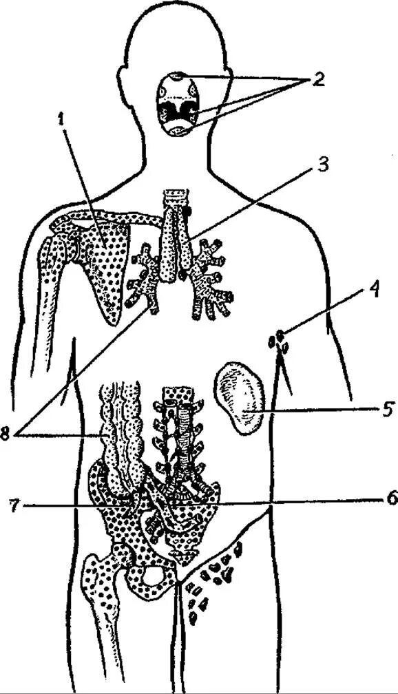 Центральные и периферические органы иммунной системы схема. Иммунная система человека схема анатомия. Схема расположения центральных и периферических органов иммунитета. Орган периферической лимфоидной системы.