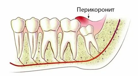 Болит зуб где