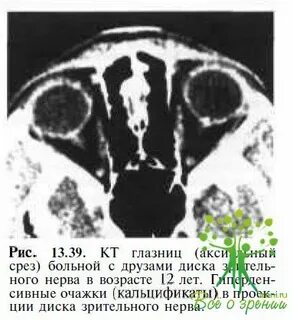 Кт 39