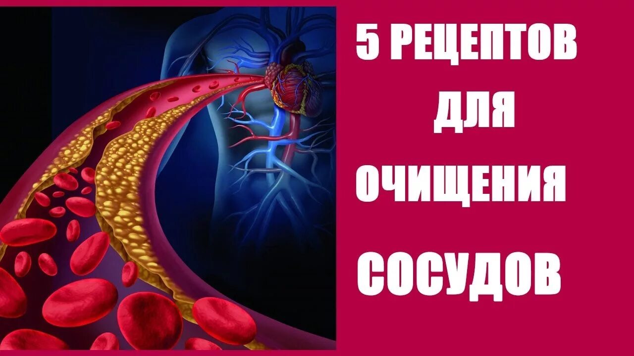 Народное лечение атеросклероза мозга