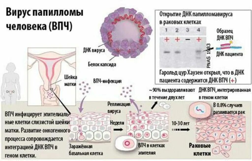 Вирус human. Патогенез папилломавирусной инфекции. ВПЧ дисплазия шейки матки. Вирус папилломы строение.