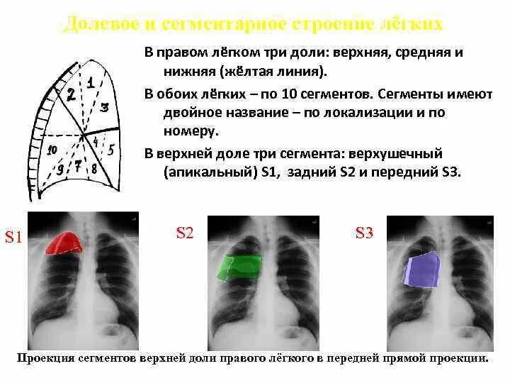 Очаговая пневмония средней доли правого легкого. Доли легкого s1 s2. Сегменты s1 s2 легких. Доли легких на рентгенограмме. Изменения в верхней доле легкого