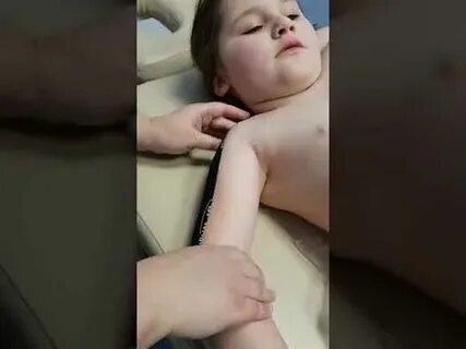 Парезы при дцп
