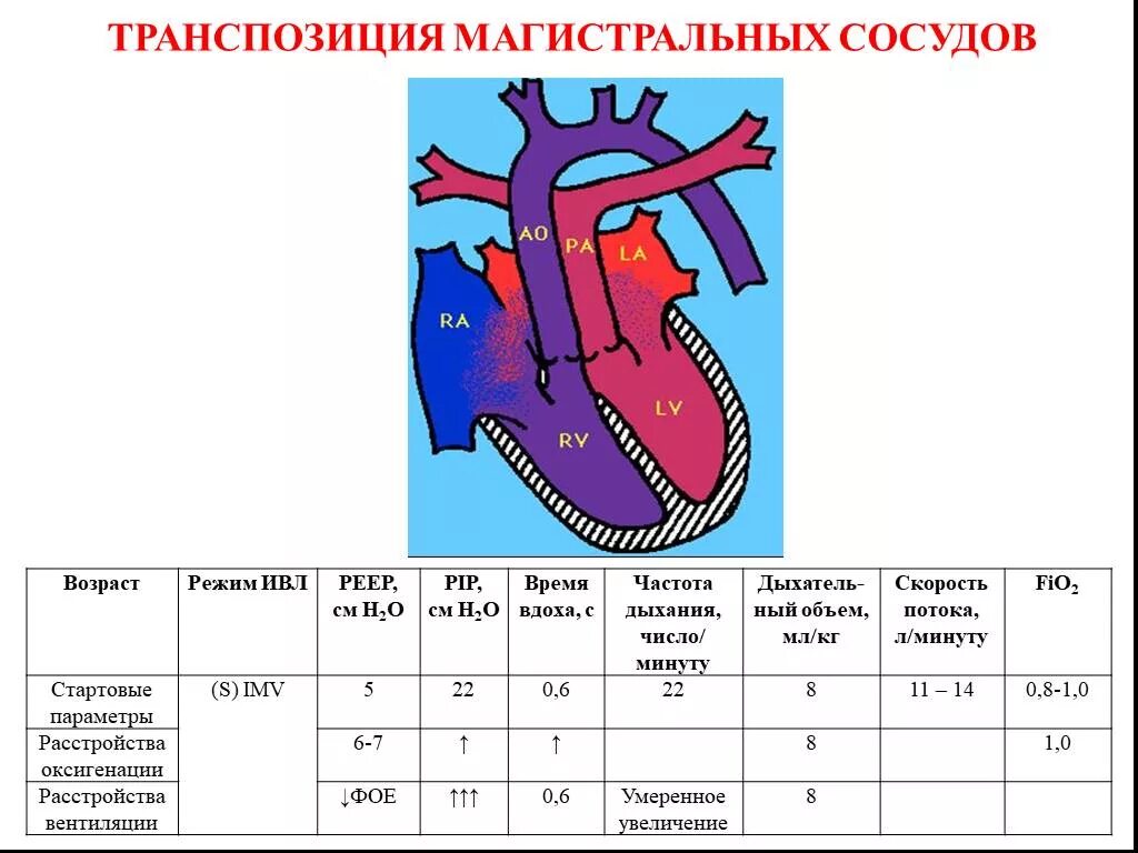 Транспозиция магистральных сосудов гемодинамика схема. Транспозиция магистральных артерий у новорожденных. Порок сердца транспозиция магистральных сосудов. Полная транспозиция магистральных сосудов у детей гемодинамика. Гемодинамика у детей