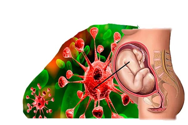 Передача от матери к плоду. Трансплацентарный путь передачи краснухи. Внутриутробный путь передачи туберкулеза. Цитомегаловирус трансплацентарный. Трансплацентарный путь передачи инфекции это.