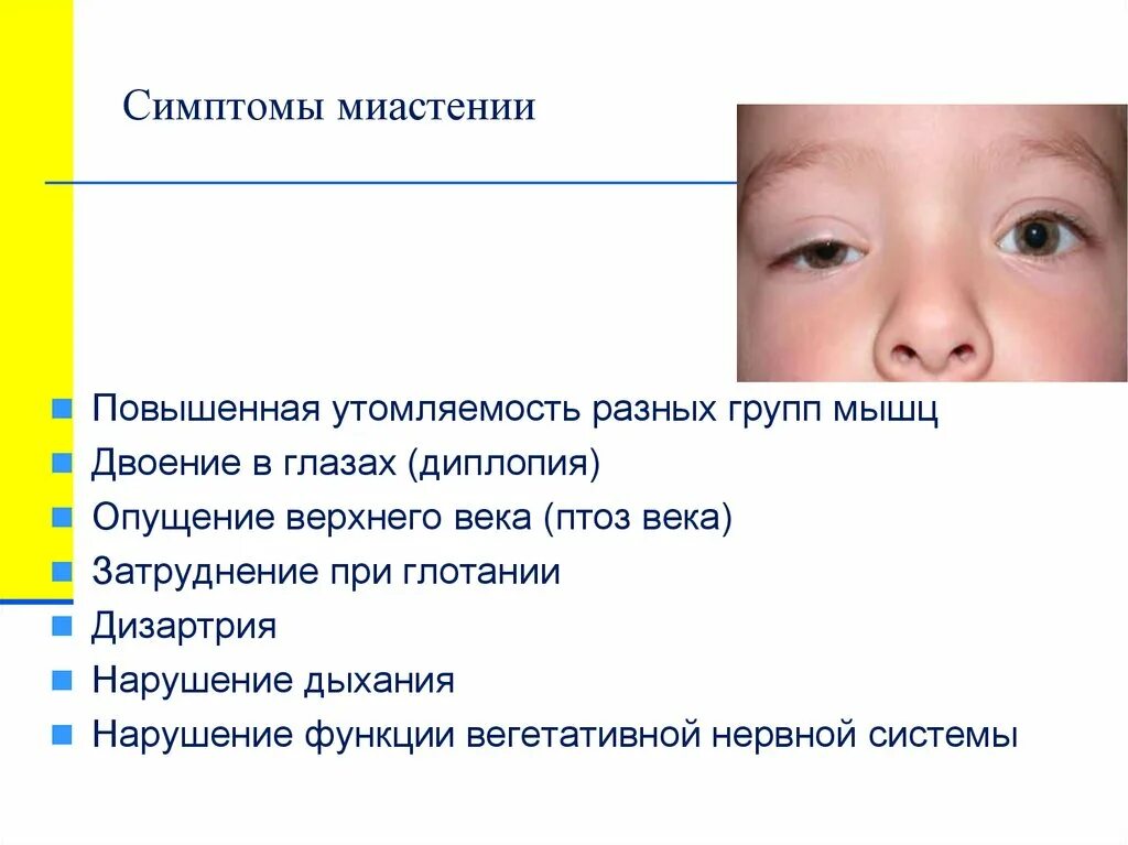 Глазная миастения гравис. Болезнь миастения. Миастения глазодвигательного нерва. Миастения клиническая картина. Глазная миастения лечение.