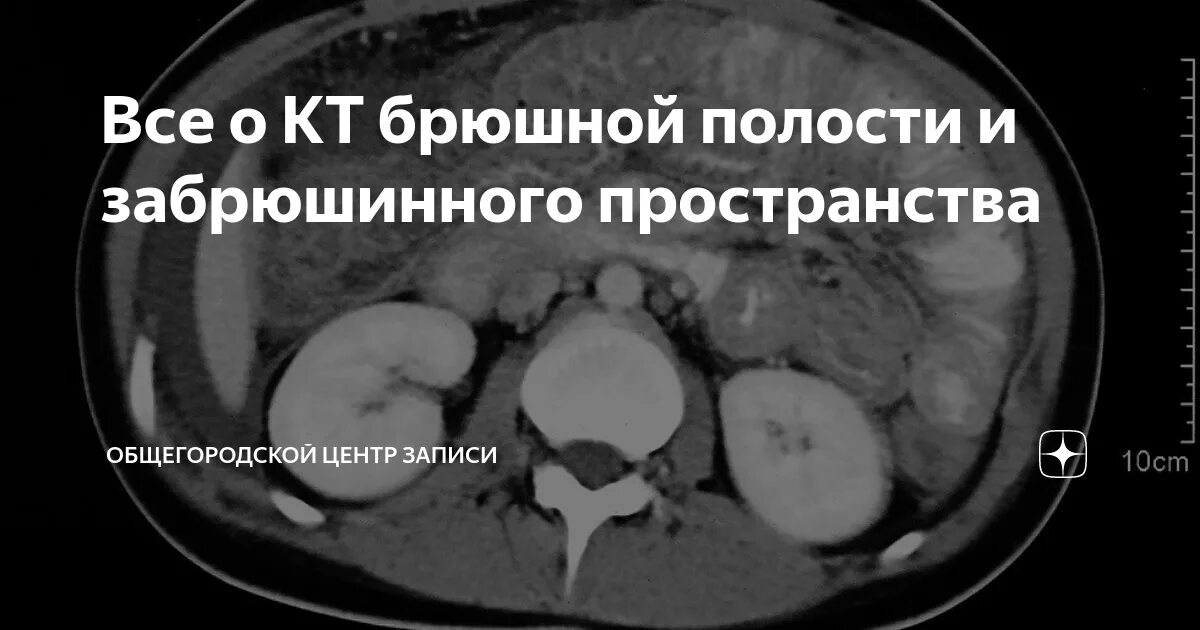 Кт брюшной полости краснодар. Кт брюшной полости краснодар