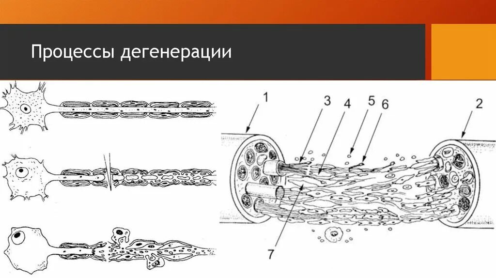 Дегенерация периферического нервного волокна.. Регенерация нервных волокон гистология. Регенерация нерва схема. Регенерация нервных волокон после повреждения.