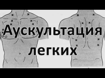 Послушать легкие