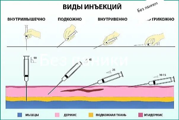 Внутрикожная игла длина. Внутрикожно и подкожно. Подкожно внутрикожно внутримышечно. Внутрикожно игла вводится под углом. Игла при подкожной инъекции.