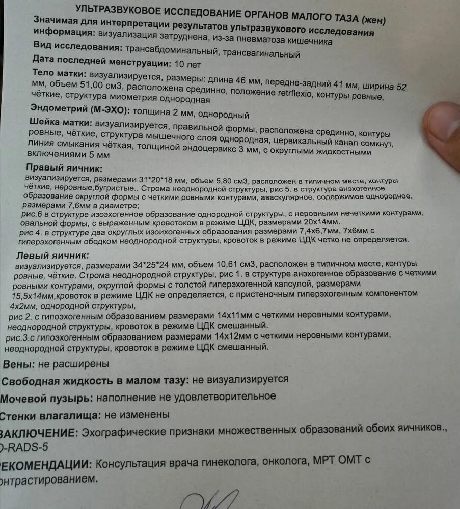 Узловое образование левой доли щитовидной железы. Аваскулярное образование что это. Аваскулярное образование что это значит. Опухолевидные образования яичников. Киста яичника на узи заключение.