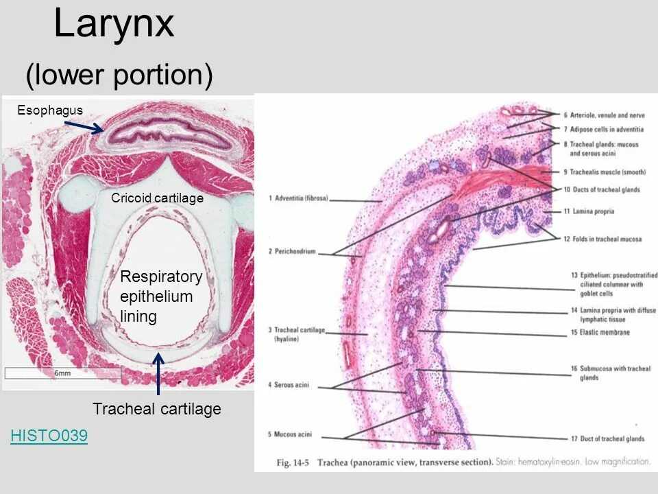 Хрящ трахеи гистология. Строение надгортанника гистология. Слизистая оболочка миндалины гистология. Глотка гистология строение. Глотка слои
