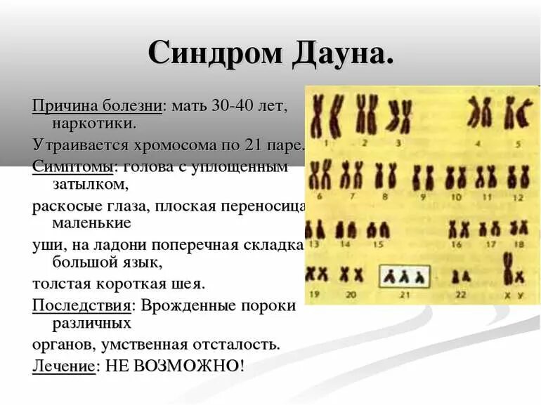 Кариотип человека с болезнью дауна. Причиной синдрома дауна являются. Причиной синдрома дауна являются. Болезнь дауна презентация. Причиной синдрома дауна являются.