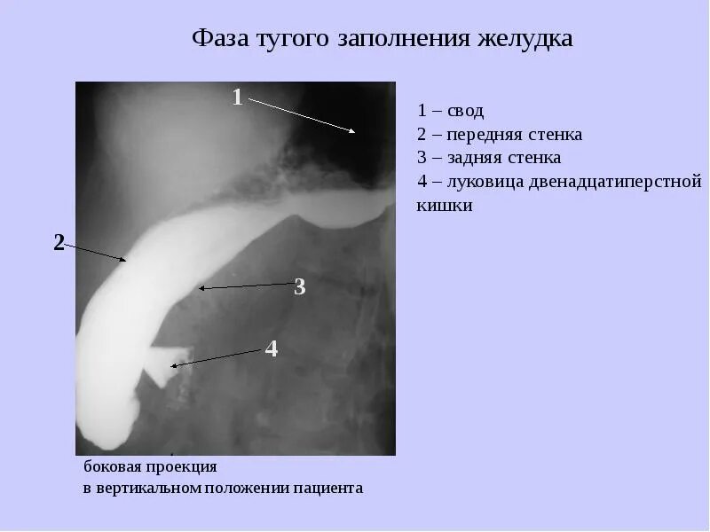 Рентгеноанатомия грудной клетки. Рентген анатомия пищевода и желудка. Нормальная рентгеноанатомия желудка.