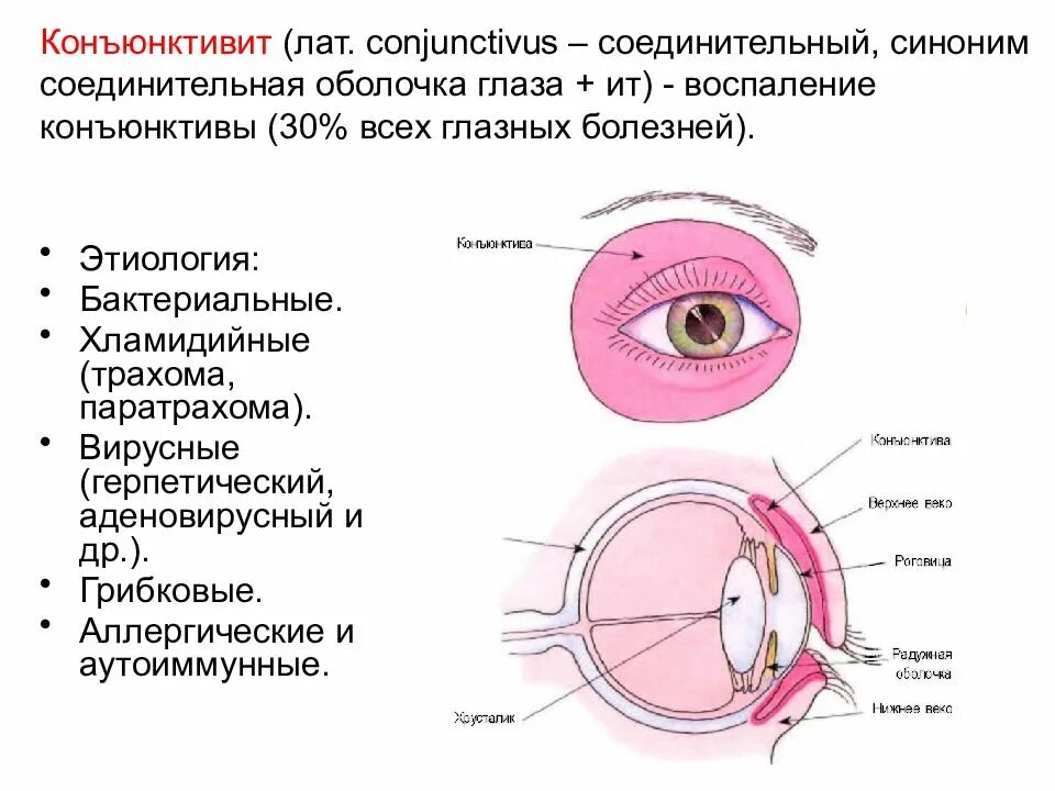 Аденовирусный конъюнктивит пленки. Хламидийное поражение глаз. Конъюнктива воспаление. Слизистая оболочка век