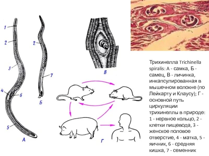 Трихинелла спиральная - Trichinella spiralis. Трихинелла Спиралис самец и самка.