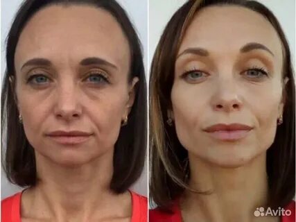 Массаж лица до и после
