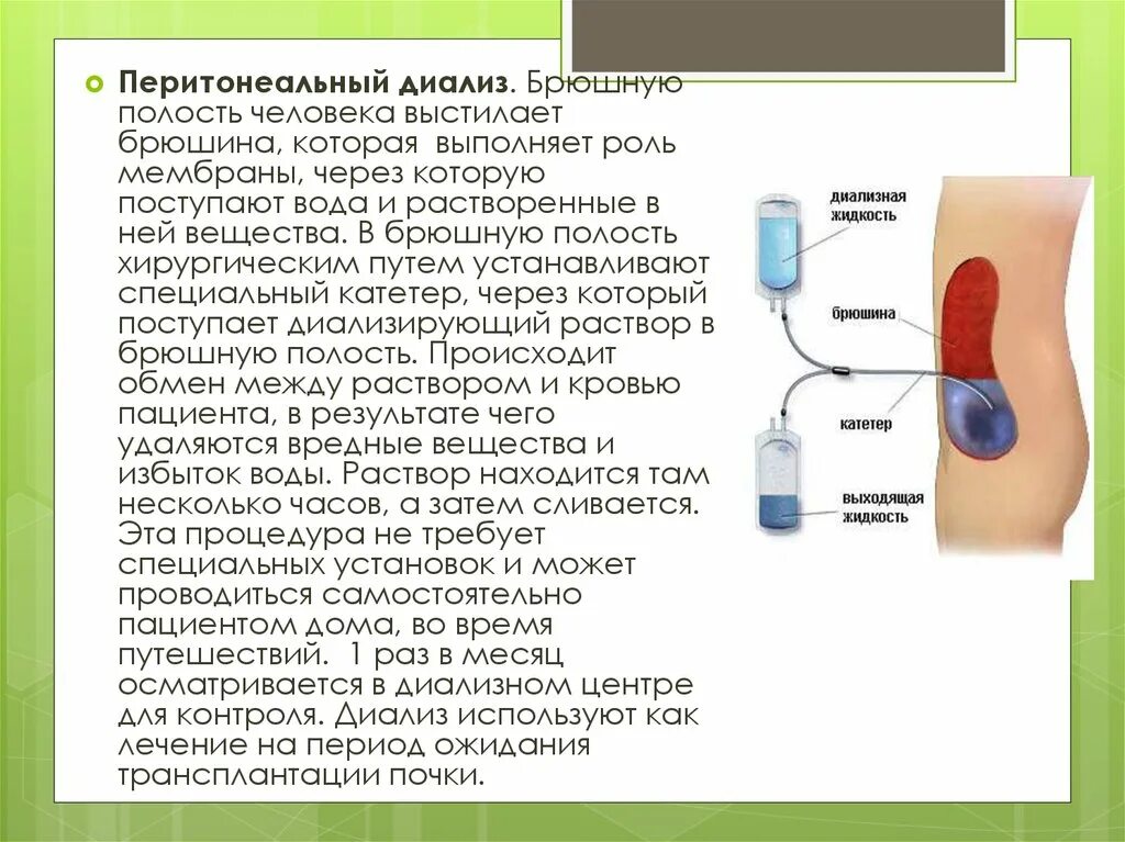 Катетер в брюшной полости. Перитонеальный катетер для диализа. Схема перитонеального диализа. Перитонеальный катетер. Перитонеальный катетер для диализа.