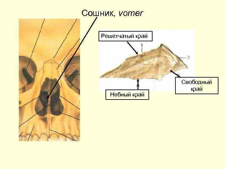 Сошник кость. Сошник анатомия человека. Сошник кость черепа. Сошник топография.