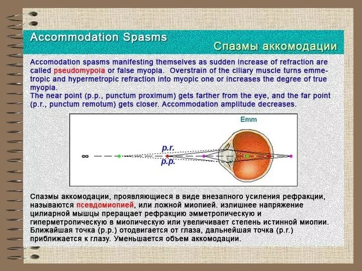 Функцию аккомодации. Спазм аккомодации мышцы. Миопия и спазм аккомодации. Спазм аккомодации хрусталика. Аккомодация механизм аккомодации спазм аккомодации.