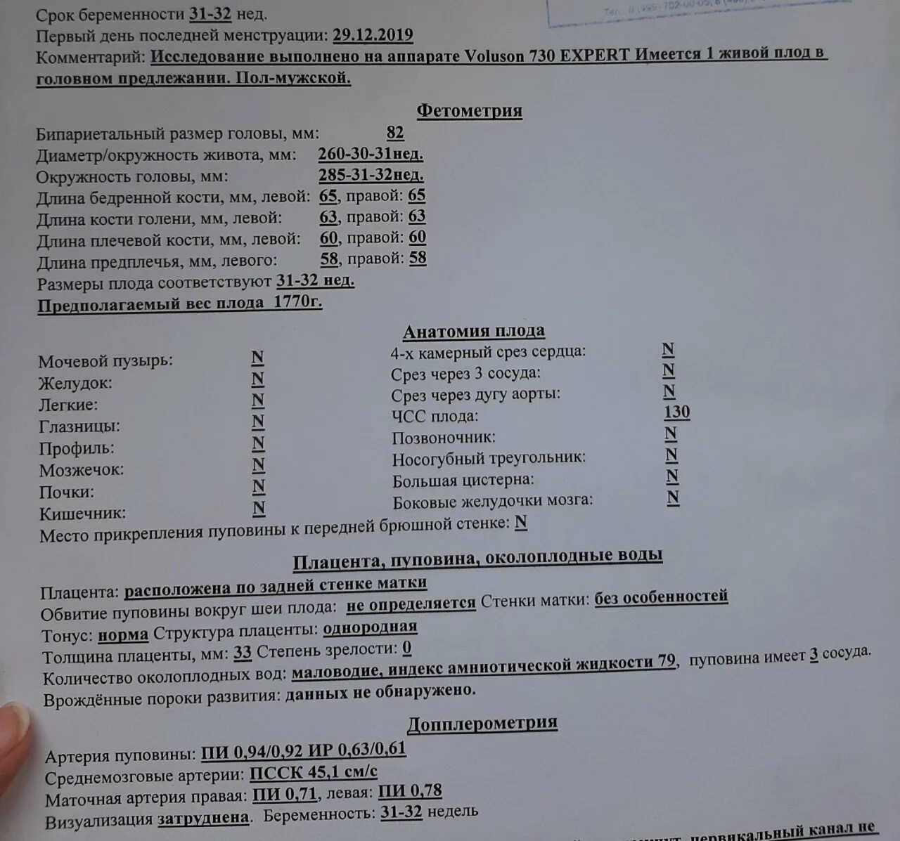 Количество околоплодных вод по неделям. Норма плода на 32 неделе беременности. УЗИ на 32 неделе беременности показатели нормы. Нормы плода на 34 недели беременности по УЗИ норма при беременности. Нормы УЗИ плода в 32 недели беременности.