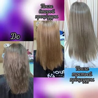 Ботокс через месяц