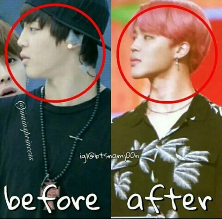 BTS-Plastic surgery or not? ARMY's Amino