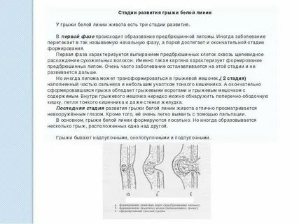 Описание грыжи
