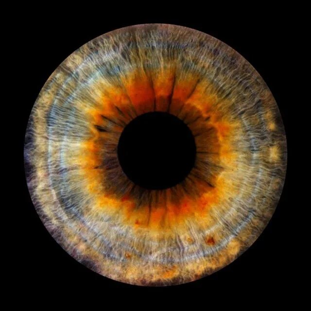 глаз под микроскопом. на орбите радужки глаз песня. оранжевые глаза. на орбите радужки глаз песня. Iris глаз.