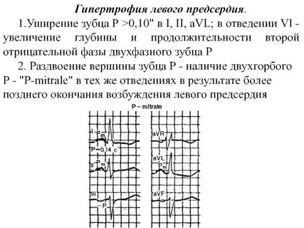 Отрицательный p