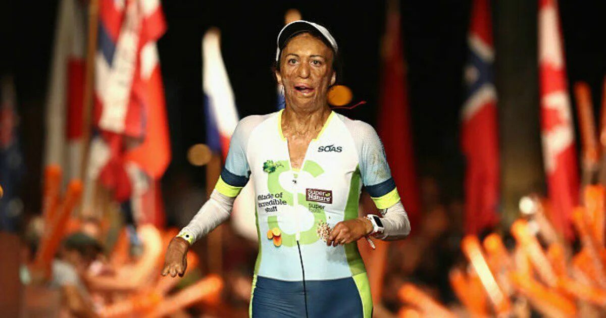 Burn survivor. Ironman hawaii. Вулит. Вулит. Burn survivor.