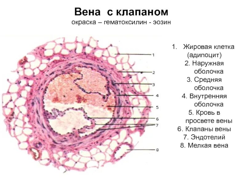 Внутренняя оболочка вен латынь. Вена мышечного типа гематоксилин эозин. Вена мышечного типа окраска гематоксилином и эозином. Бедренная Вена кошки окраска гематоксилином и эозином. Вена окраска гематоксилин.