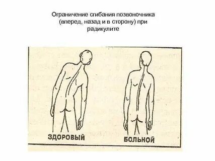 Сгибание позвоночника