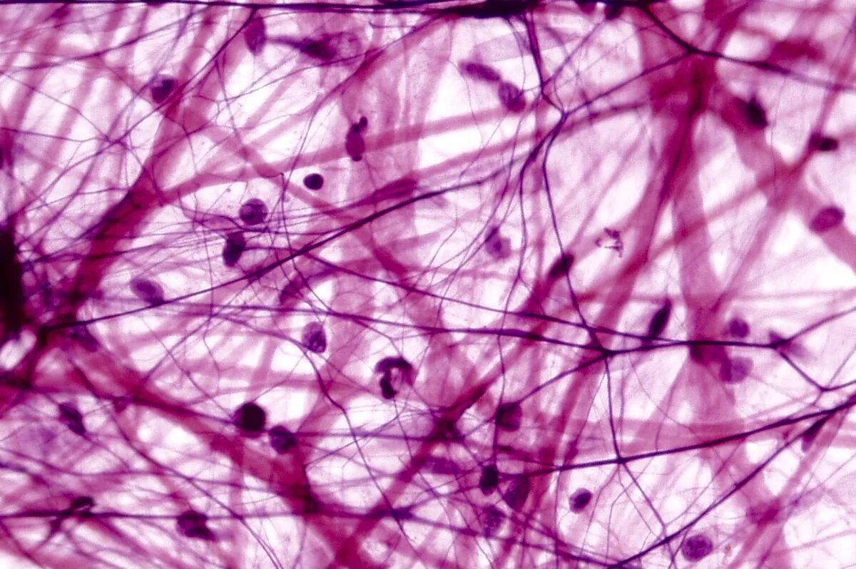 Human Anatomy Epithelial Tissues Ch 4 Part 1 - YouTube