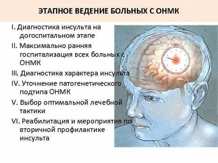 Тест нарушение мозгового кровообращения