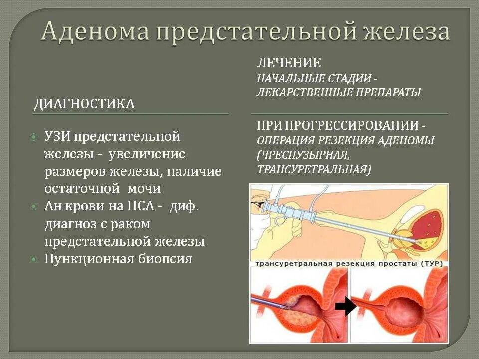 Дгпж операция