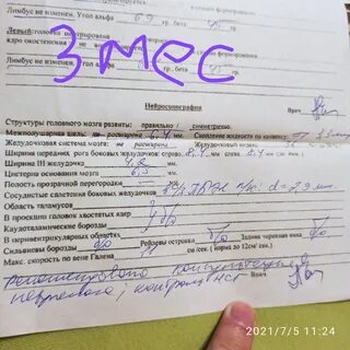 Нейросонография ул зенитчиков 3 корп 2