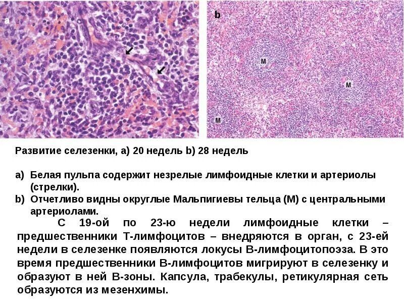 Ткань селезенки. Клетки Ходжкина гистология. Строение селезенки гистология. Трабекулярная Вена селезенки гистология. Гиперплазия селезенки гистология.