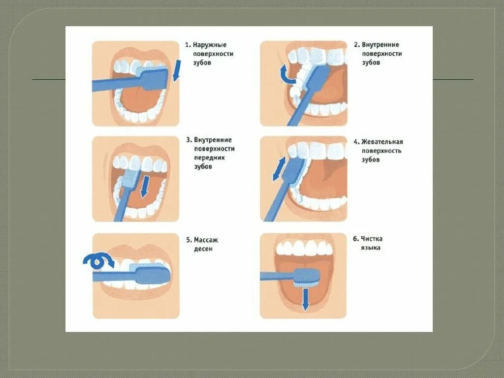 Схема чистки зубов. Правильно чистить зубы. Правильный метод чистки зубов. Стандартная техника чистки зубов. Чистить значение