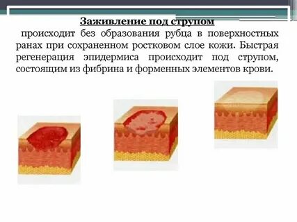 Сколько затягивается рана после удаления