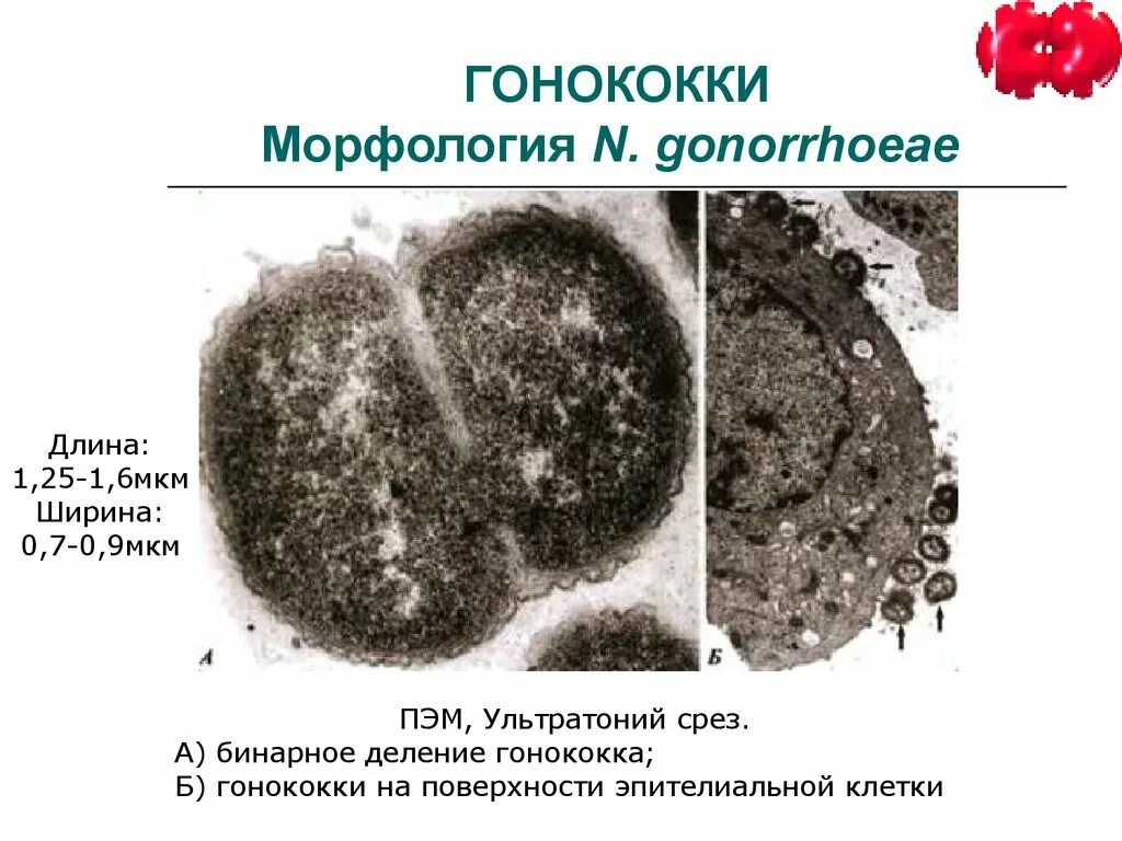 Грамм отрицательные кокки. Гонококки грамположительные или грамотрицательные. Менингококки электронная микроскопия. Грамотрицательные коккобактерии. Кокки гонококки.